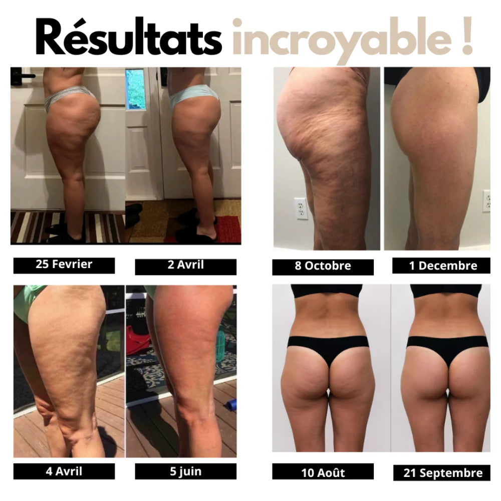 Leggings anti-cellulite 3D