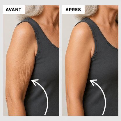 Manchons Calmira 3D – Redessinez vos bras sans effort
